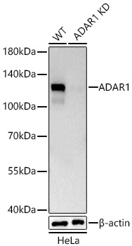 [KD Validated] ADAR1 Rabbit mAb