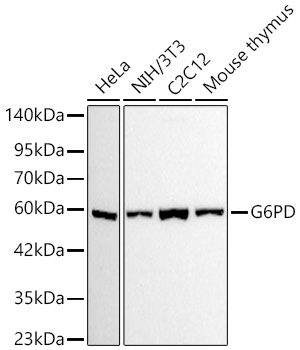 G6PD Rabbit mAb