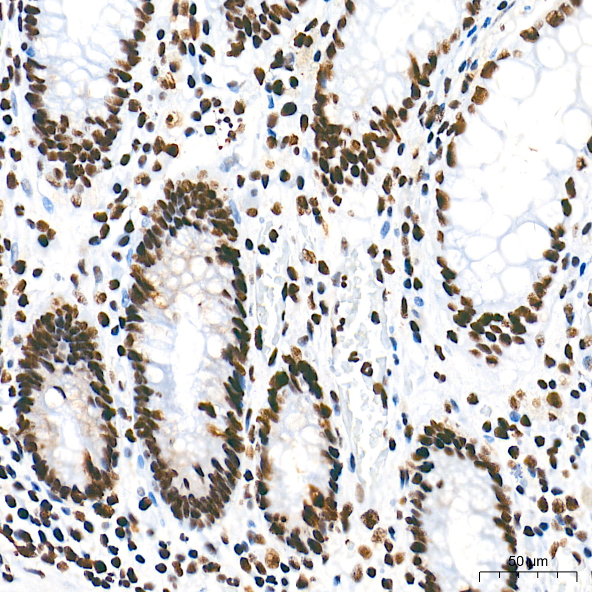 Nucleophosmin Rabbit mAb