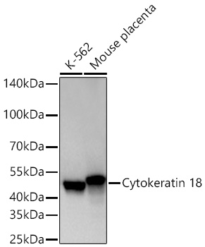 Cytokeratin 18 Rabbit mAb