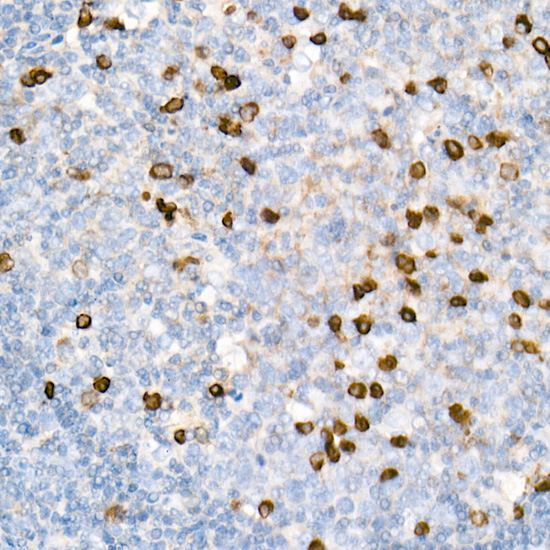 Rabbit anti-Human IgG (Fc) mAb