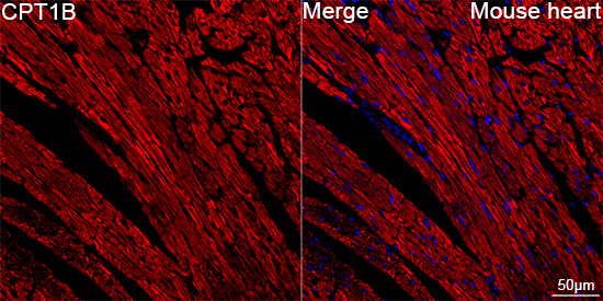 CPT1B Rabbit mAb