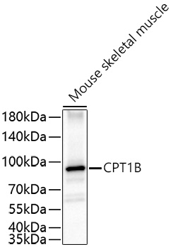 CPT1B Rabbit mAb
