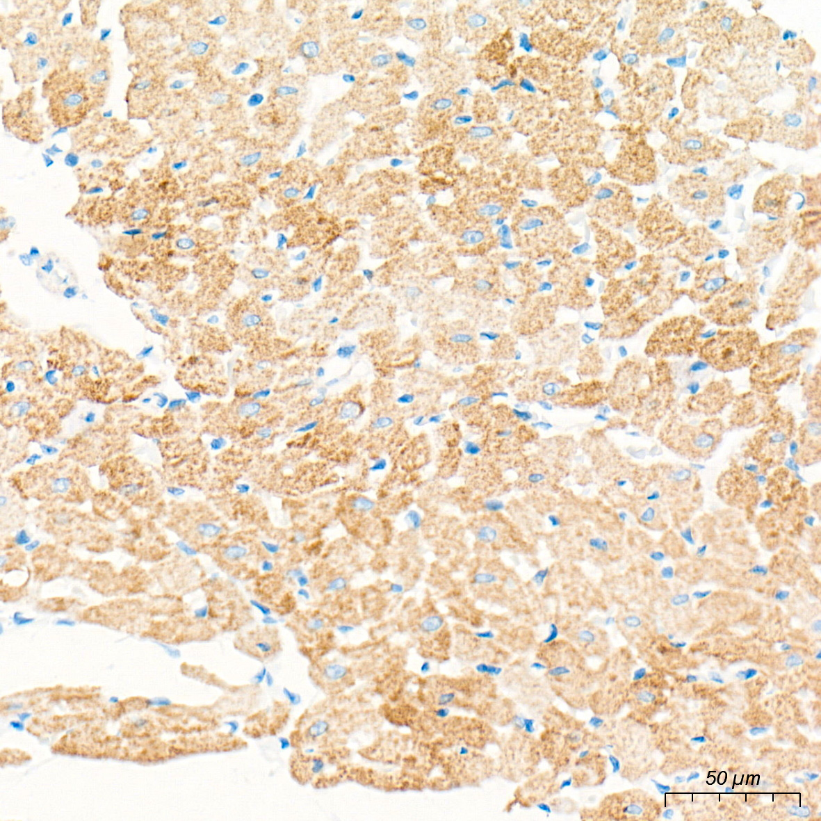 CPT1B Rabbit mAb