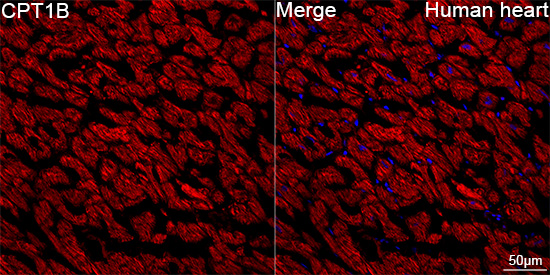 CPT1B Rabbit mAb