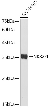 NKX2-1 Rabbit pAb