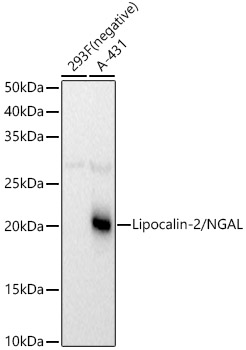 Lipocalin-2/NGAL Rabbit pAb