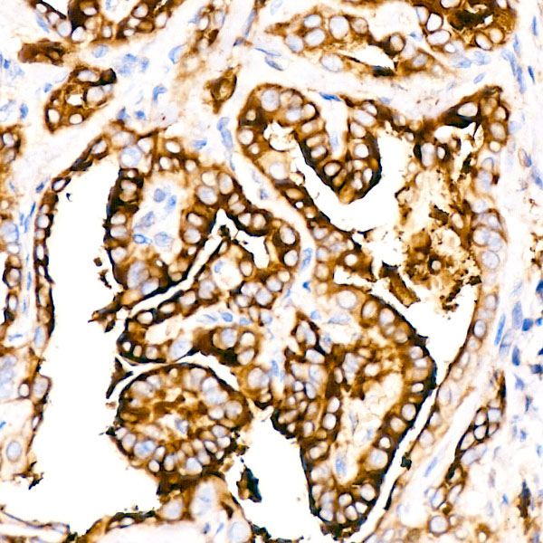 Thyroglobulin Rabbit mAb