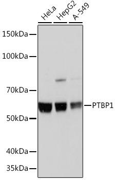 PTBP1 Rabbit mAb