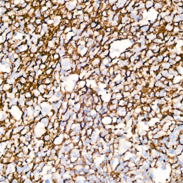 CD35/CR1 Rabbit mAb