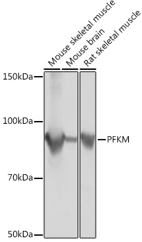 PFKM Rabbit mAb