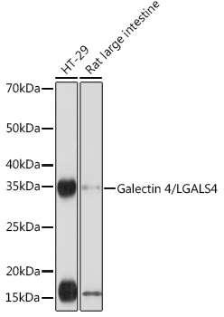 Galectin 4/LGALS4 Rabbit mAb