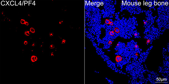 CXCL4/PF4 Rabbit mAb