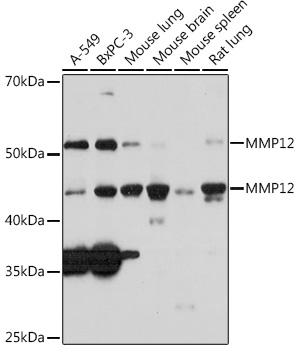 MMP12 Rabbit mAb