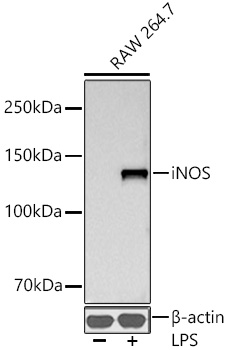 iNOS Rabbit mAb