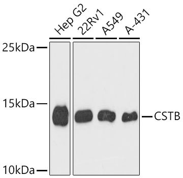 CSTB Rabbit pAb