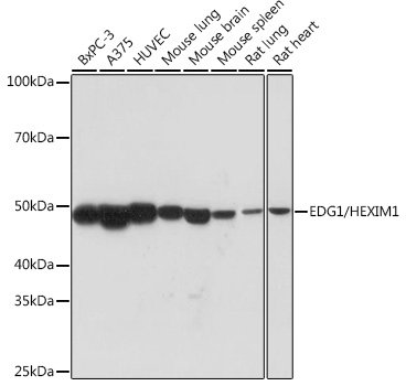 EDG1/HEXIM1 Rabbit mAb