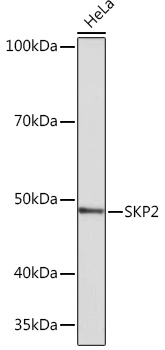 SKP2 Rabbit mAb