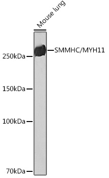 【福袋セール】の商品 SMMHC/MYH11 Rabbit mAb ジャケット・アウター