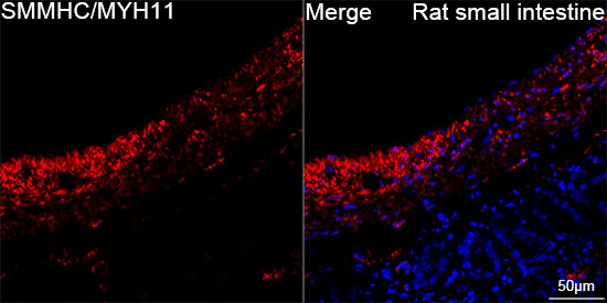 SMMHC/MYH11 Rabbit mAb