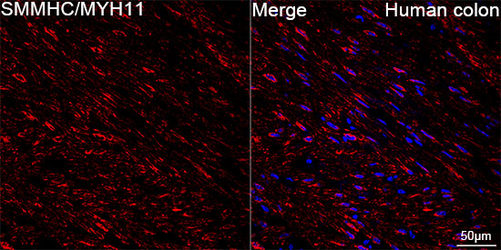 SMMHC/MYH11 Rabbit mAb