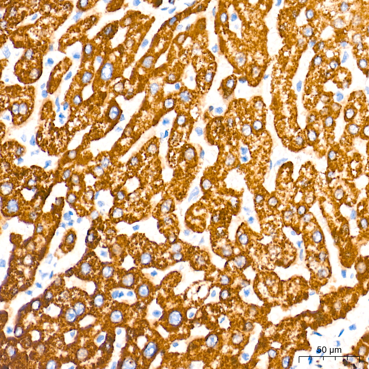 Monoamine Oxidase A (MAOA) Rabbit mAb