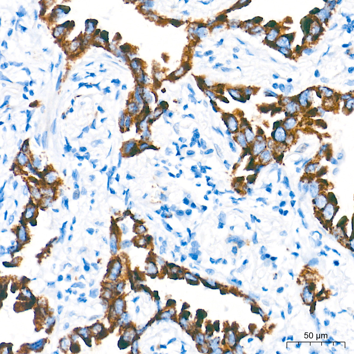 Monoamine Oxidase A (MAOA) Rabbit mAb
