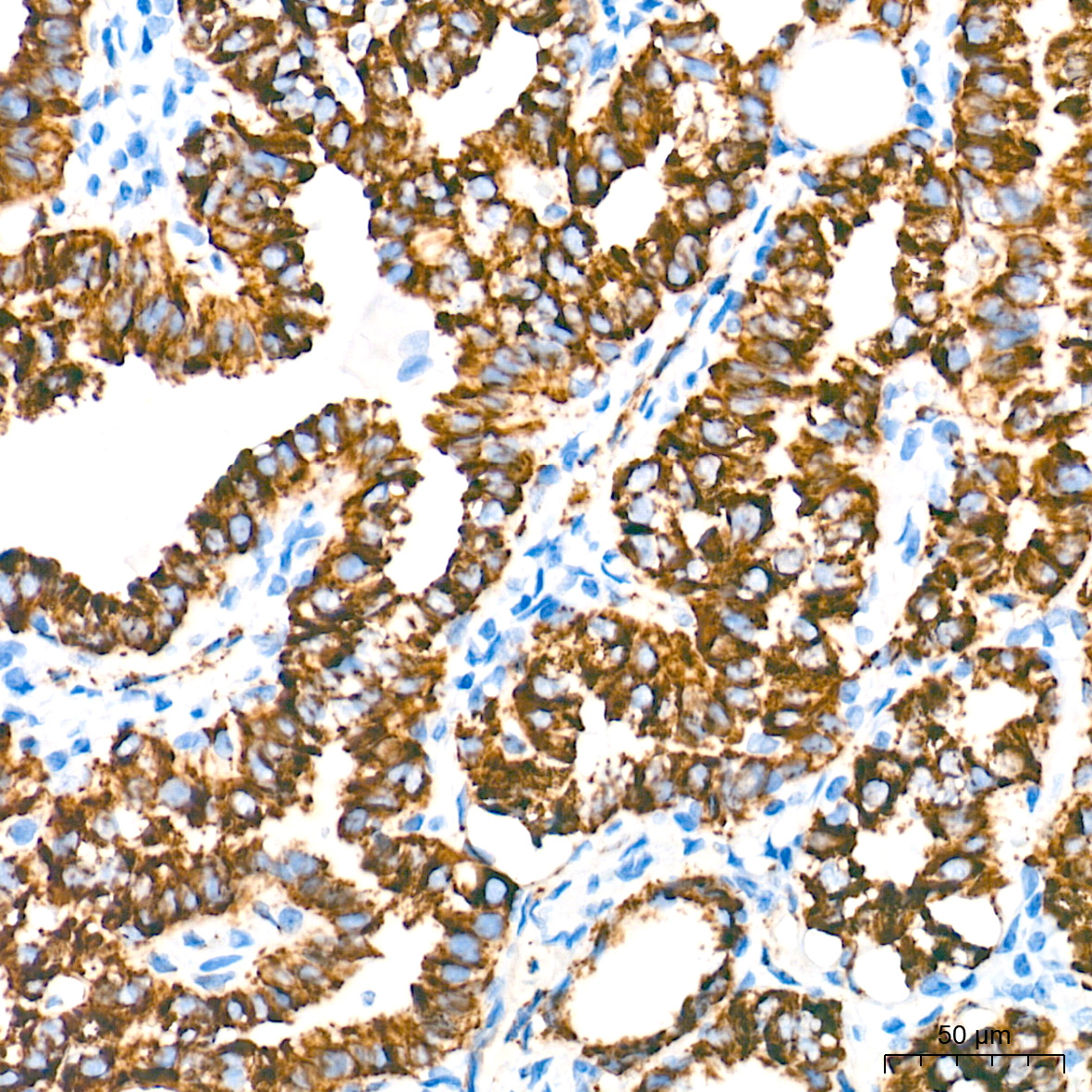 Monoamine Oxidase A (MAOA) Rabbit mAb