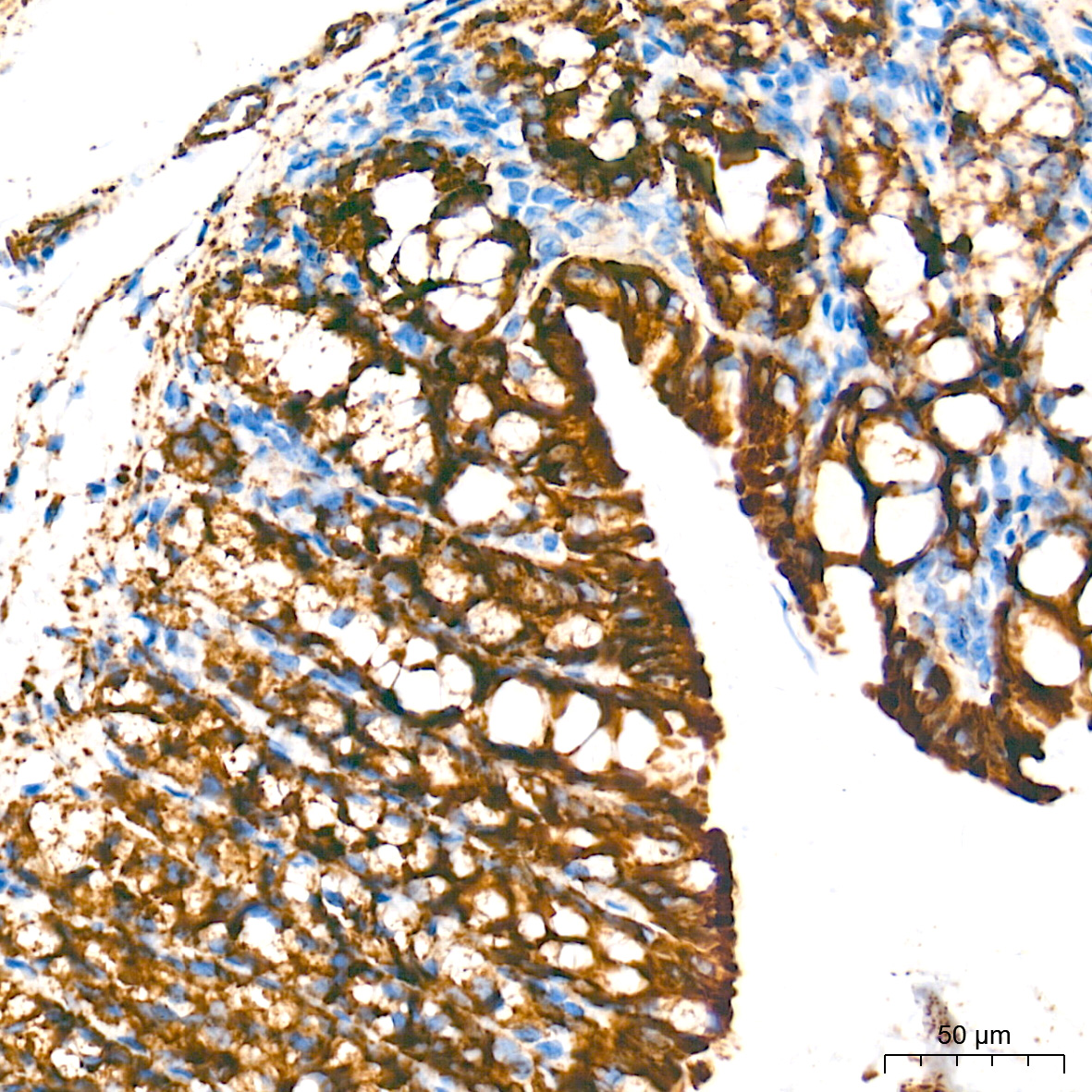 Monoamine Oxidase A (MAOA) Rabbit mAb