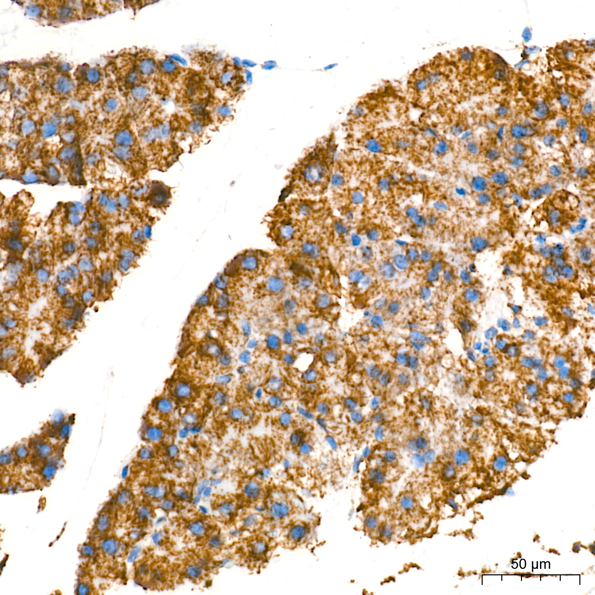 Monoamine Oxidase A (MAOA) Rabbit mAb