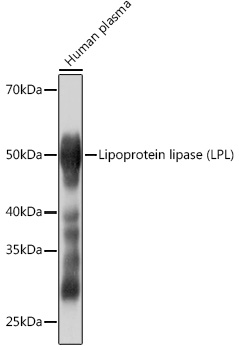 Lipoprotein lipase (LPL) Rabbit mAb