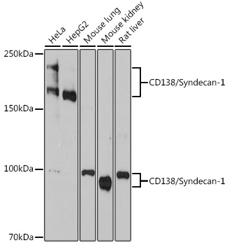 CD138/Syndecan-1 Rabbit mAb