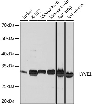 LYVE1 Rabbit mAb