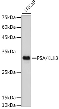 PSA/KLK3 Rabbit mAb