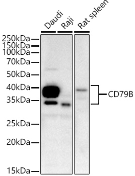 CD79B Rabbit mAb