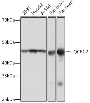 UQCRC2 Rabbit mAb