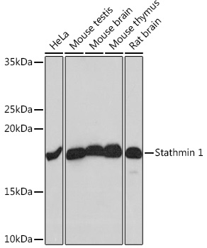 Stathmin 1 Rabbit mAb