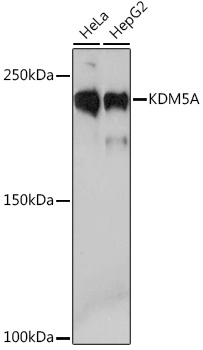 KDM5A Rabbit mAb