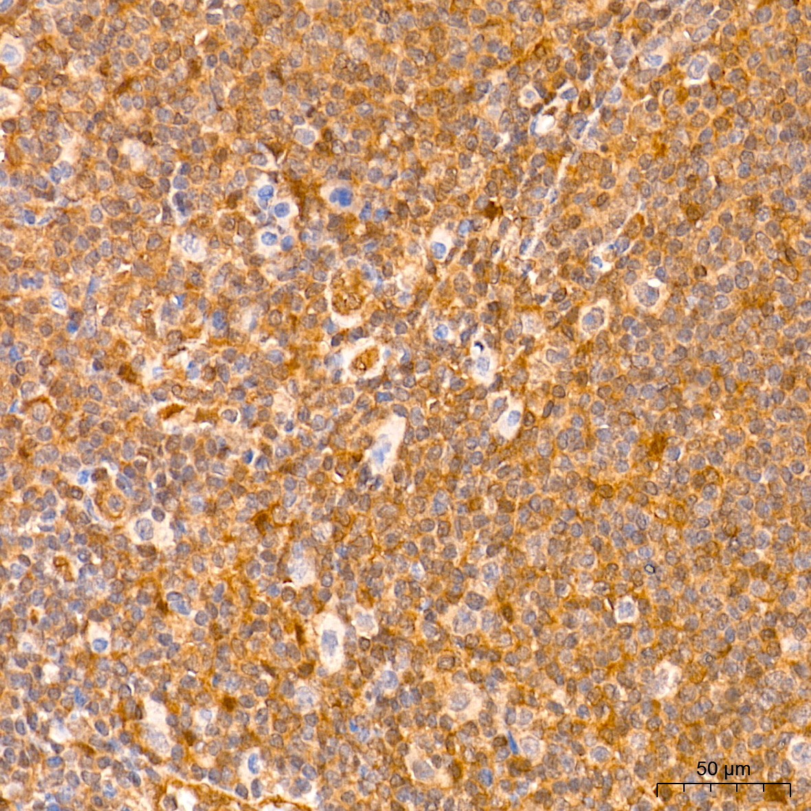 erkページ ERK1/2 Rabbit mAb