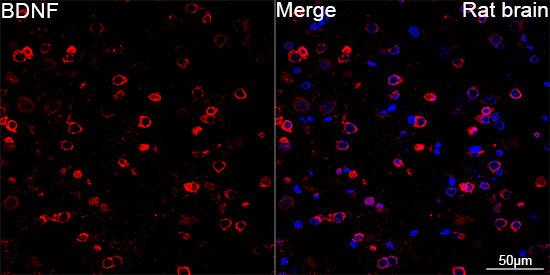ベネニフィラ　まん丸 BDNF Rabbit mAb