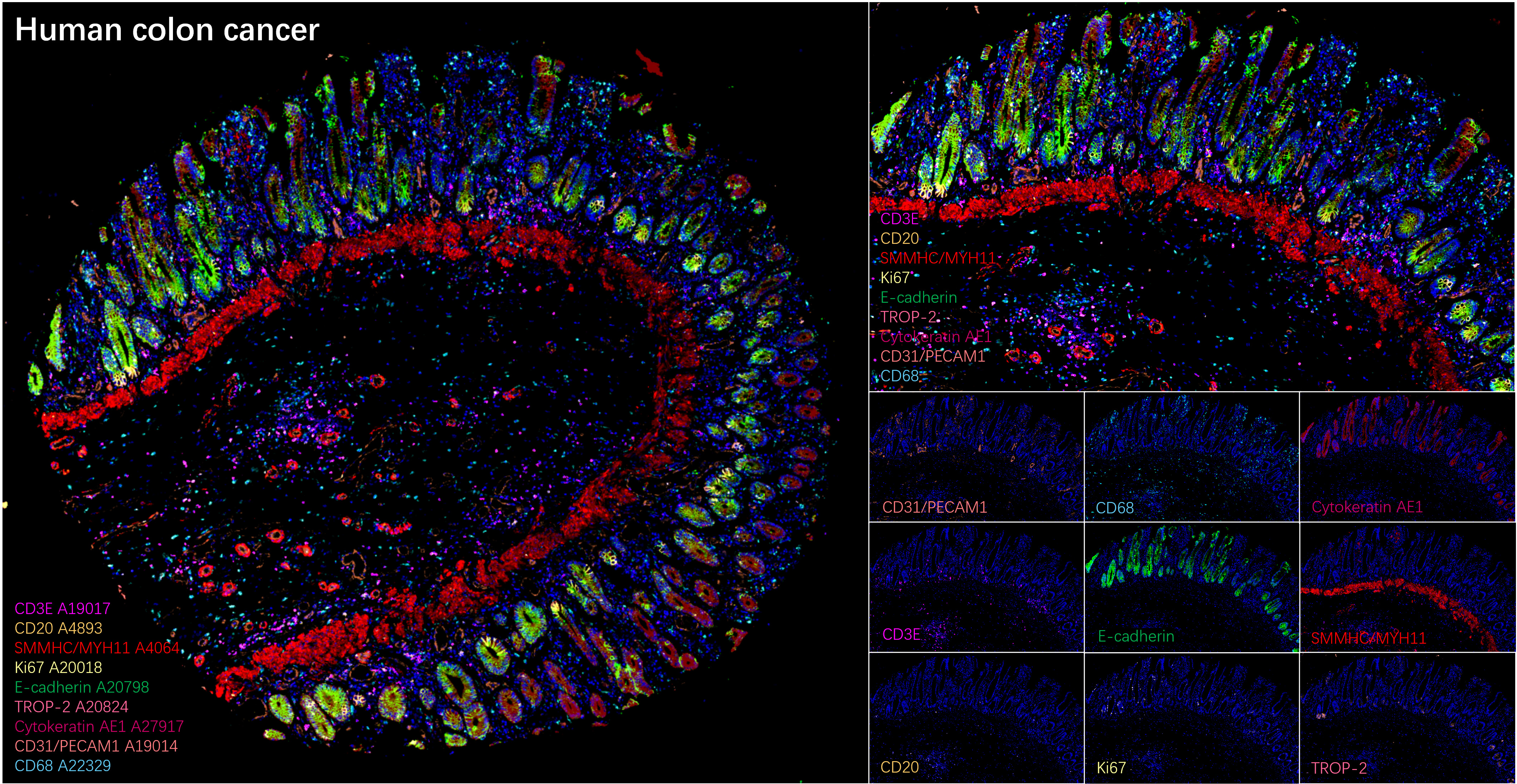 CD20 Rabbit mAb