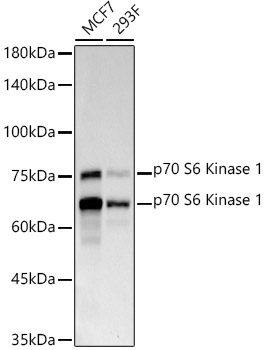 p70 S6 Kinase 1 Rabbit mAb