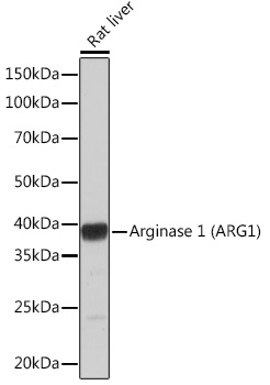 K様20:20 Arginase 1 (ARG1) Rabbit mAb