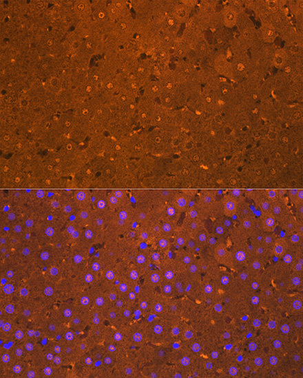 Arginase 1 (ARG1) Rabbit mAb