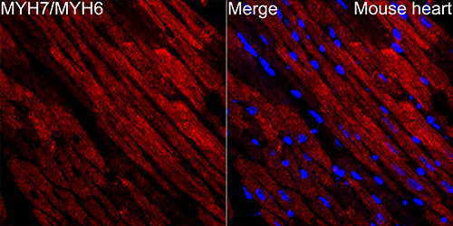 Myosin heavy chain Rabbit mAb