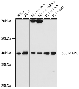 p38 MAPK Rabbit mAb