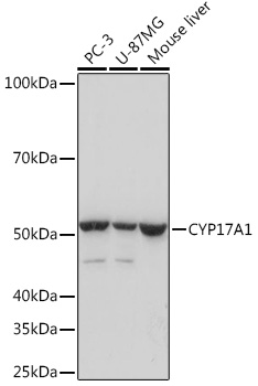 CYP17A1 Rabbit mAb