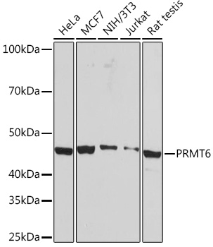 PRMT6 Rabbit mAb