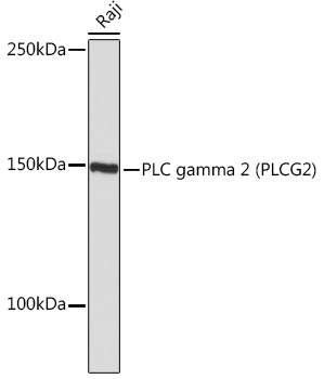 PLC gamma 2 (PLCG2) Rabbit mAb