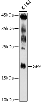 GP9 Rabbit pAb